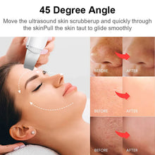 Load image into Gallery viewer, Ultrasonic Skin Scrubber