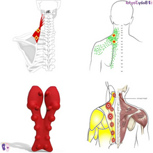 Load image into Gallery viewer, Neck Tension/Pain Relief Device