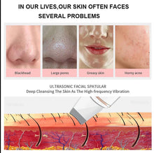 Load image into Gallery viewer, Ultrasonic Skin Scrubber