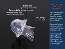 Load image into Gallery viewer, Apnea Tongue Stabilizing Device