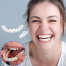 Load image into Gallery viewer, Smile Veneer (Upper & Lower Included)
