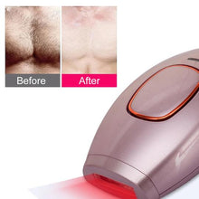 Load image into Gallery viewer, IPL LASER HAIR REMOVAL HANDSET AT HOME