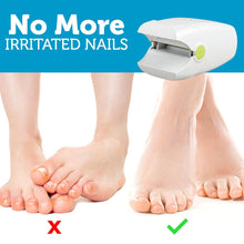Load image into Gallery viewer, Revolutionary Toe And Fingernail Nail Fungus Home Remedies Treatment Laser Device
