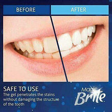 Load image into Gallery viewer, Complete Teeth Whitening Kit At Home With LED Light Included - Until Times Up