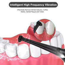 Load image into Gallery viewer, Dental Calculus Removal at Home
