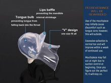 Load image into Gallery viewer, Apnea Tongue Stabilizing Device
